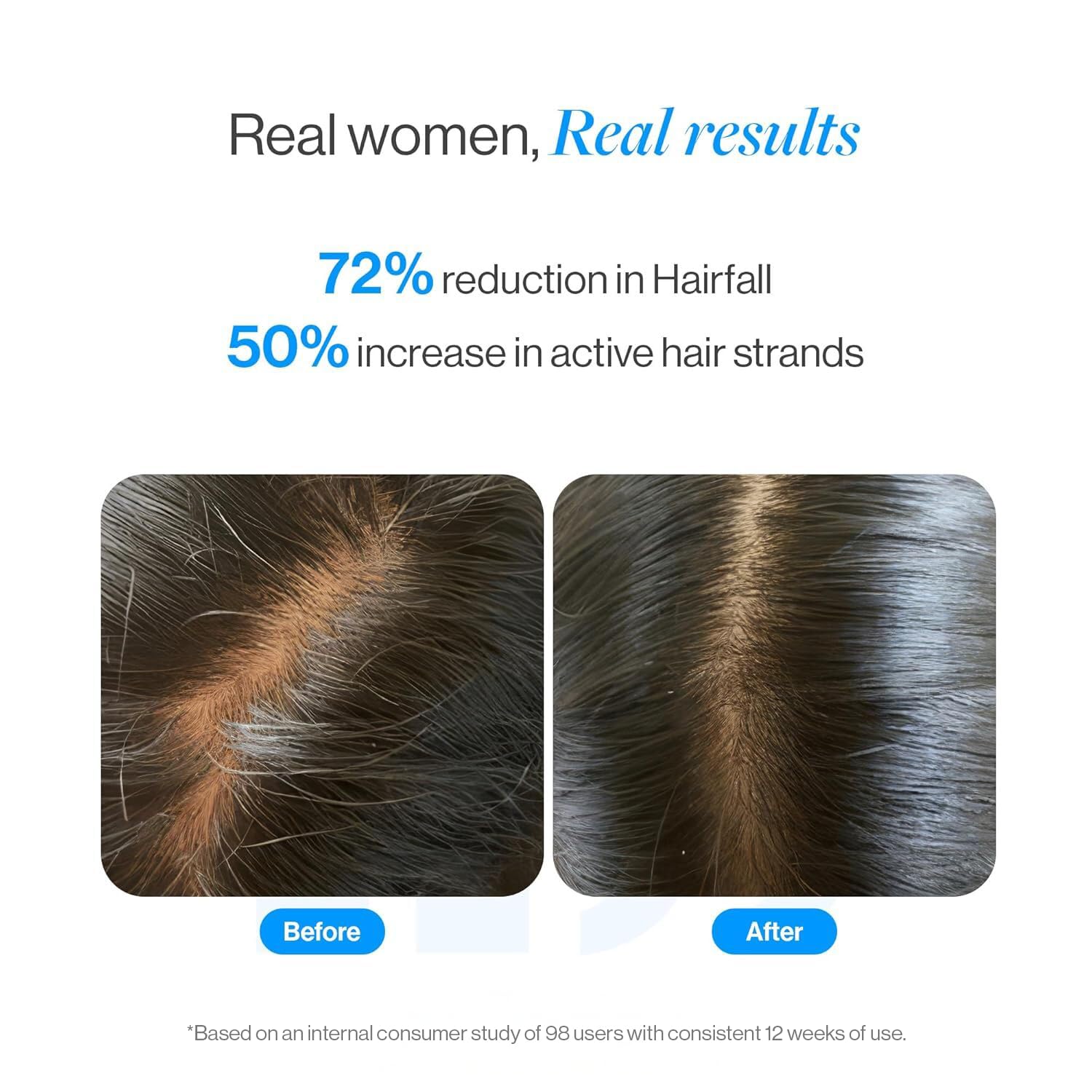 Be Bodywise 3% Redensyl & Rosemary Hair Growth Serum (Roll On) | Pack of 2 |with 2% Anagain | Thicker & Stronger Hair | Prevents Hairfall & Stimulates Hair Follicles | For All Hair Types | 25ml each